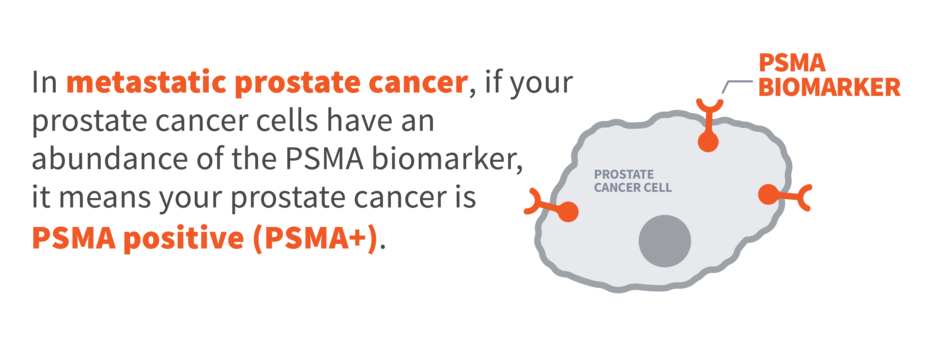 In metastatic prostate cancer, if your prostate cancer cells have an abundance of the PSMA biomarker, it means your prostate cancer is PSMA positive (PSMA+)