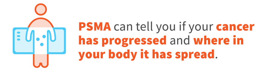 PSMA can tell you if your cancer has progressed and where in your body it has spread
