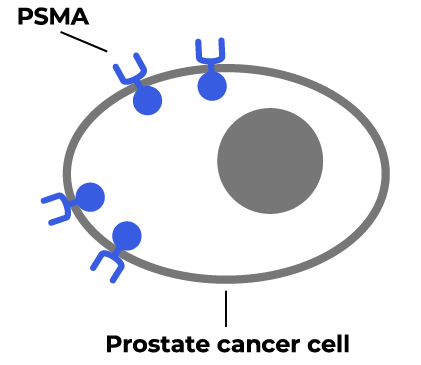 Image of a prostate cancer cell with PSMA on the surface.