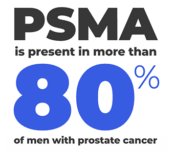 PSMA is present in more than 80% of men with prostate cancer.